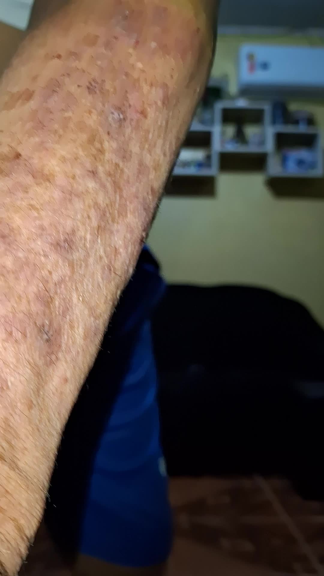 Exibicionismo e masturbação masculina