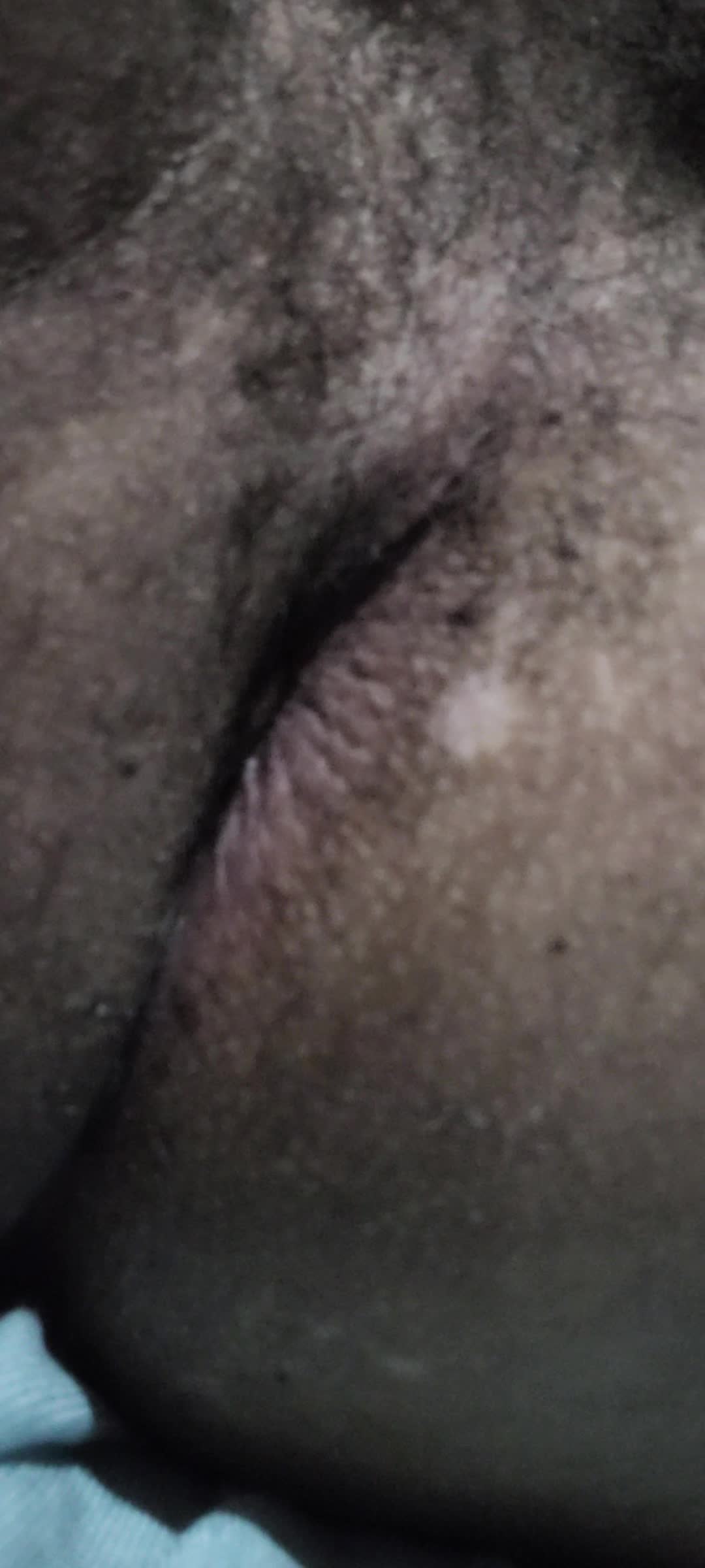 fetiches ânus, orifício anal